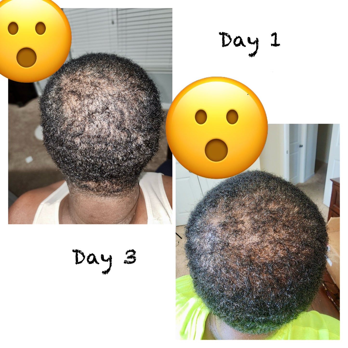 19-in-1 Hair Oil